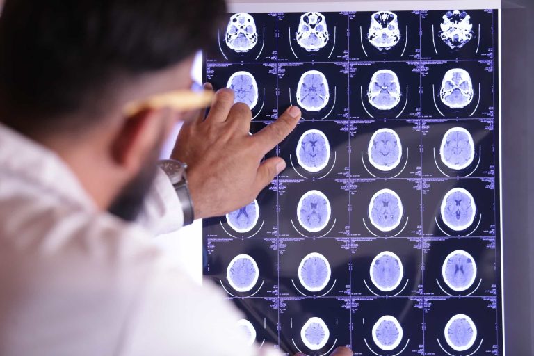 doctors examining the brain x-ray